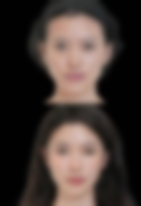 丁章尧医生眼部整形怎么样可靠吗？