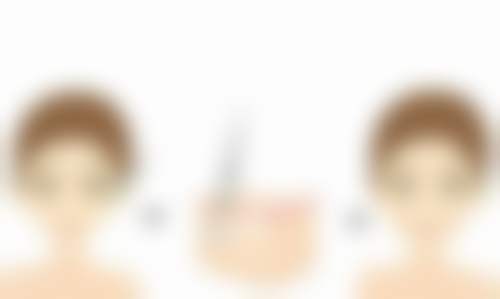 四、郑州安佳美容整形医院实例