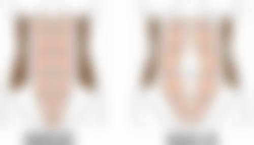 割双眼皮如何避免显假？选对方法特别重要