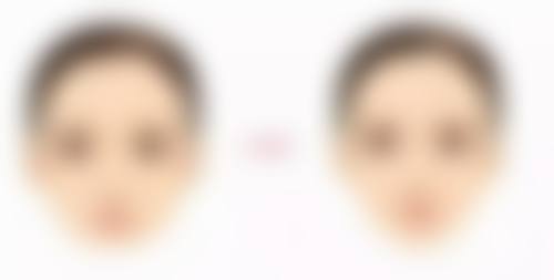 如何巧妙去除黑疤痕？多种方法结合，淡化色素、修复肌肤效果显著！ 