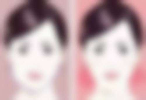 脸上冻伤疤痕去除之手术切除的适用情况