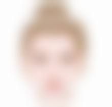 割双眼皮为何显假？揭秘瘢痕增生、设计不当等因素对术后效果的影响 