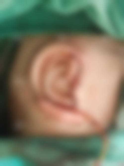 七、濮阳美硕医疗美容门诊部价格表：（仅供参考）