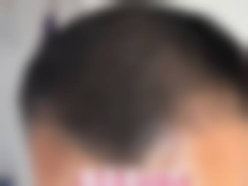 八、郑州大学第一附属医院整形外科真实的顾客评价如下：