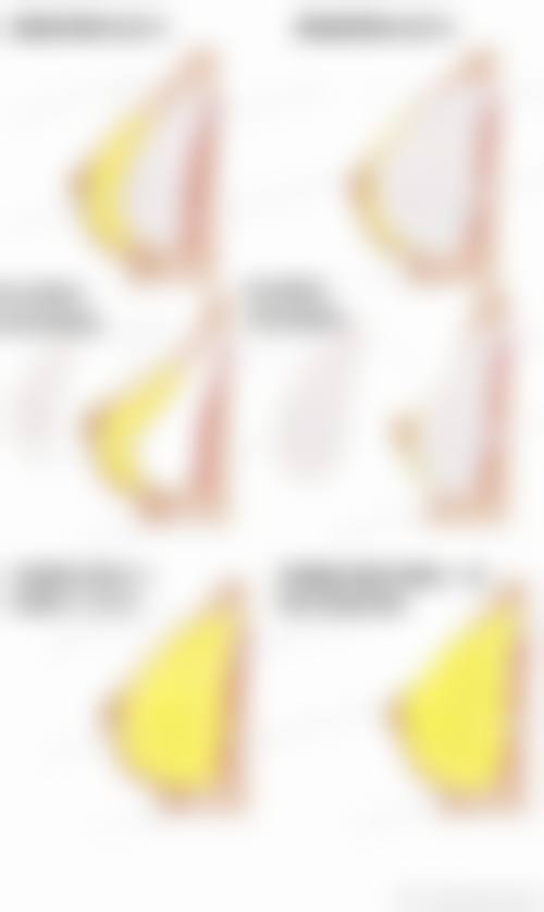 五、株洲嘉美医疗美容实例