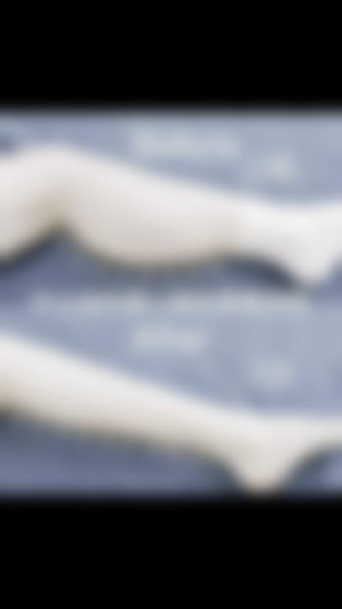 五、郑州大学第一附属医院整形外科实例