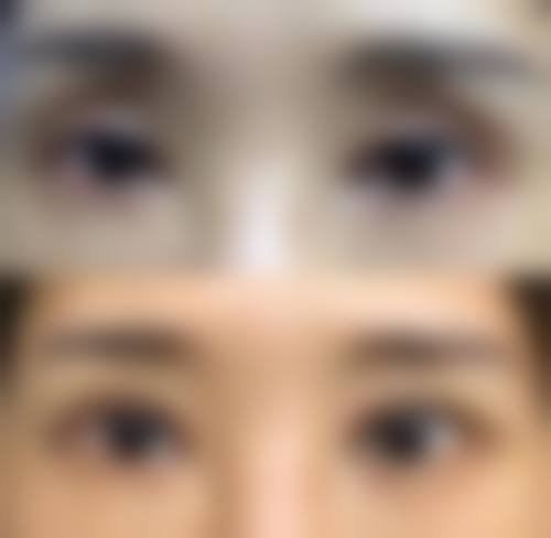 五、西安西美整形中 心实例