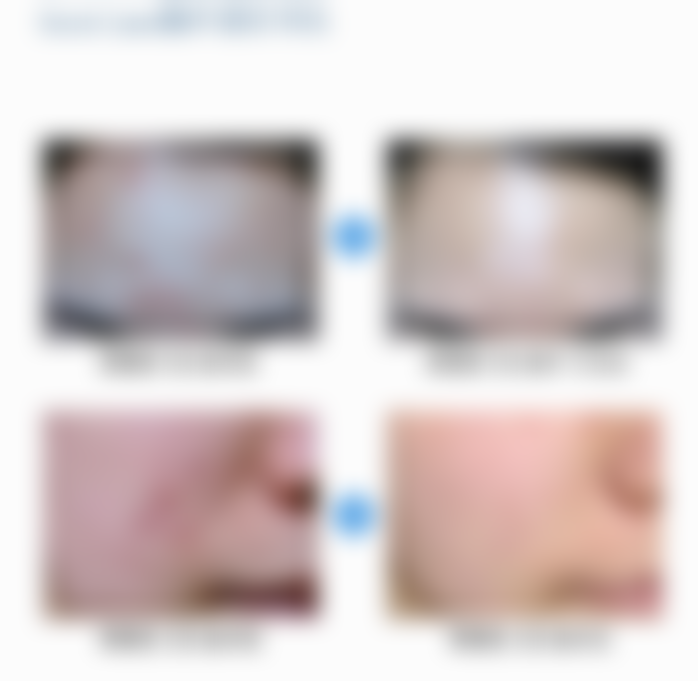 黄在英医生祛斑怎么样可靠吗？