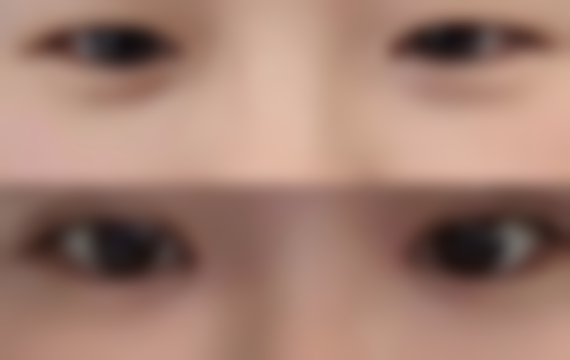 六、新昌县人民医院整形美容科怎么预约：