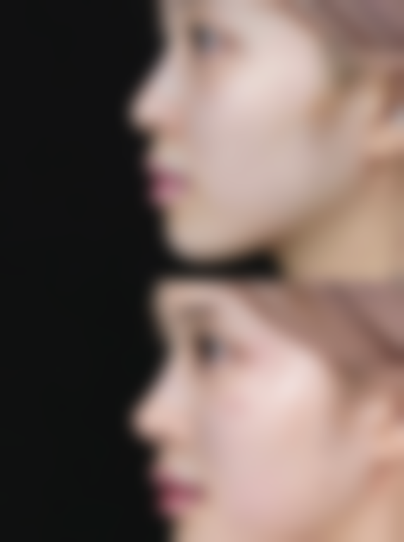 五、浙江杭州艺美紫馨医疗美容怎么预约：