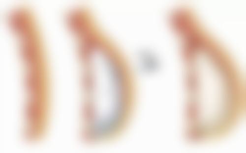 一只单眼皮一只双眼皮是咋回事？遗传、发育差异等多因素揭开神秘面纱 