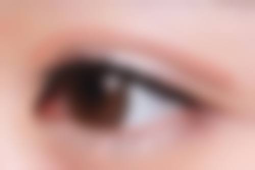 蔡里医生眼部整形实例