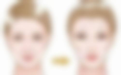 术后护理影响眼袋手术修复进程