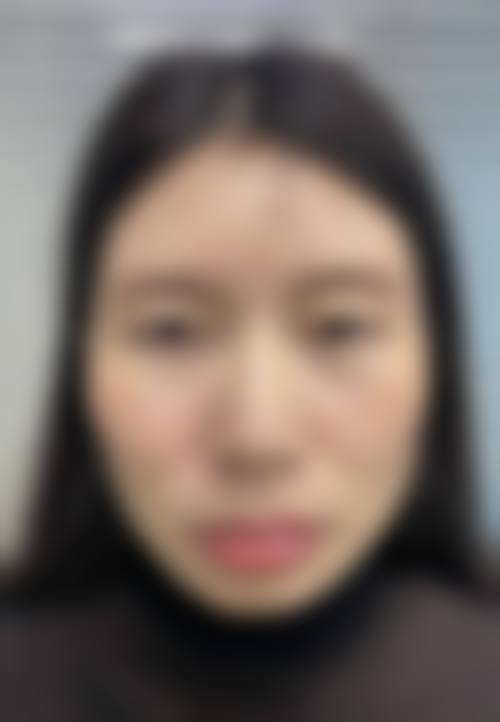 七、北京玉之光整形医院价格表：（仅供参考）