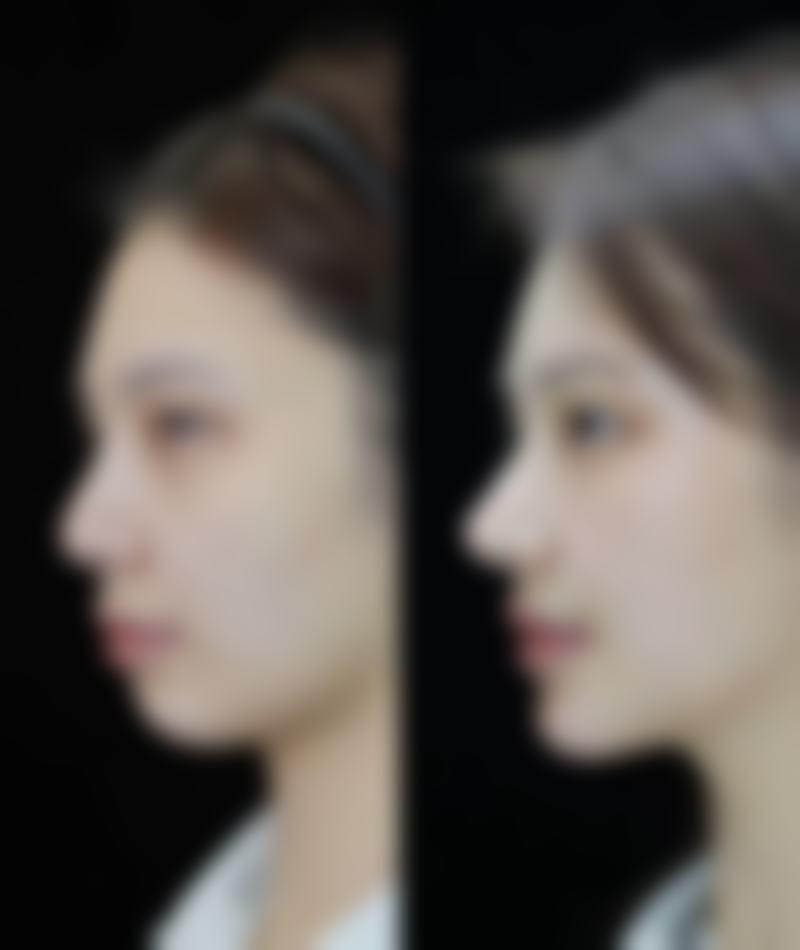 七、长沙皕诚和隽医疗美容门诊部价格表：（仅供参考）