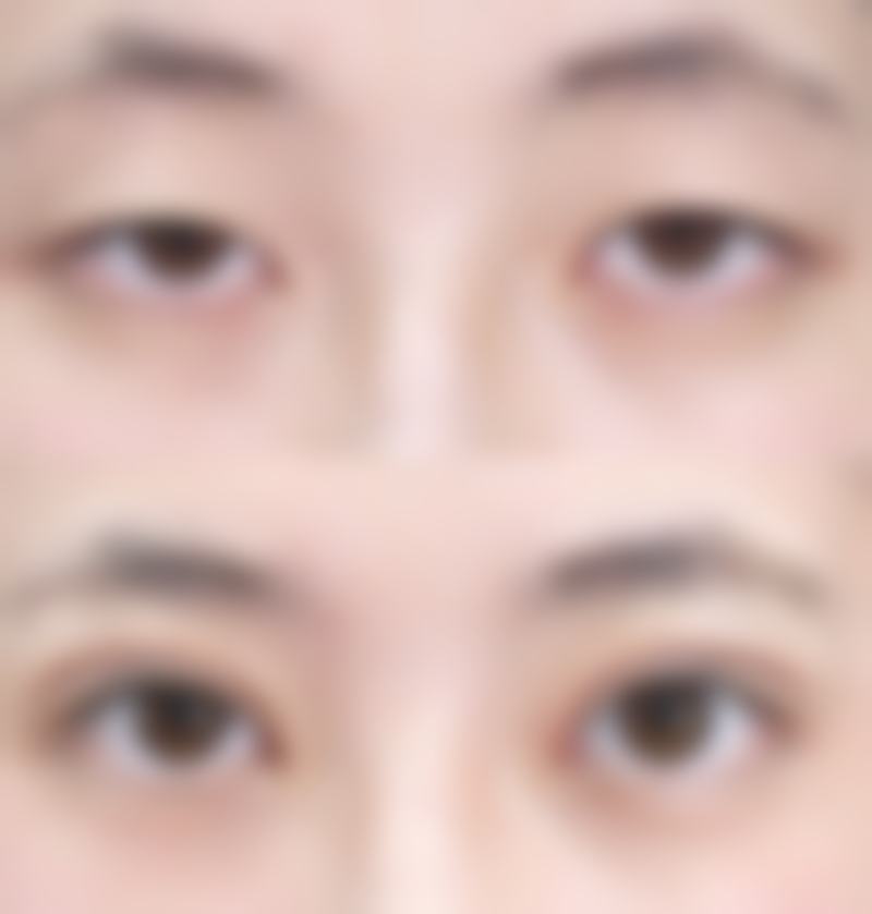 八、北京玉之光整形医院真实的顾客评价如下：