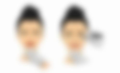 揭秘！治好疤痕疙瘩的药物有哪些？口服外用联合，多途径消除瘢痕困扰 