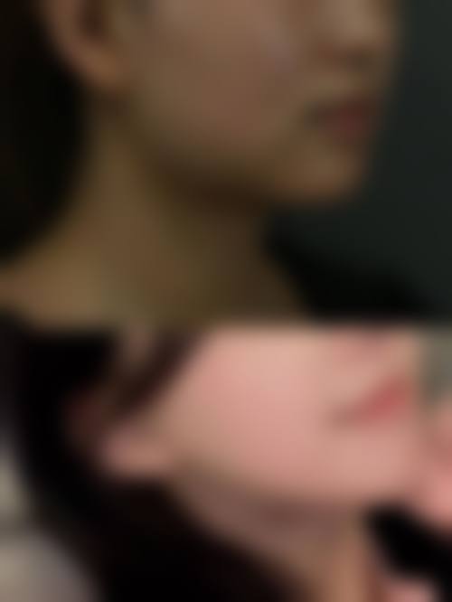 八、衡阳美莱整形美容医院真实的顾客评价如下：