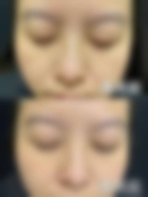 六、韩国 melab 皮肤科价格表：（仅供参考）