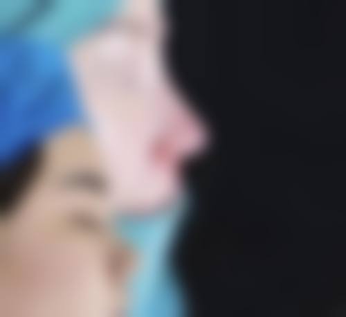 五、江西亘美宝时婕医疗美容实例