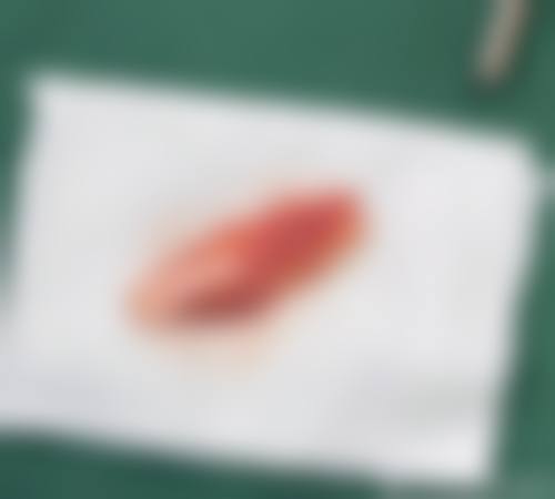 黄志新医生在哪家医院