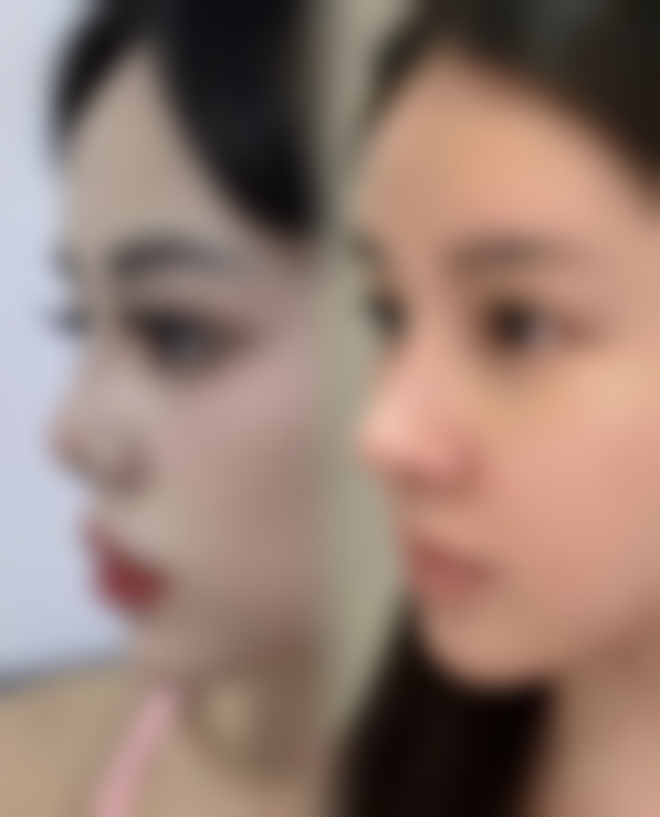 五、娄底仁爱医院整形外科实例