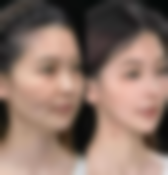 温丽霞医生项目价格表参考