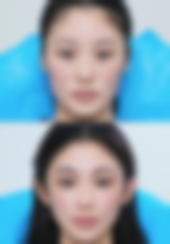 揭秘！治好疤痕疙瘩药物使用的注意事项