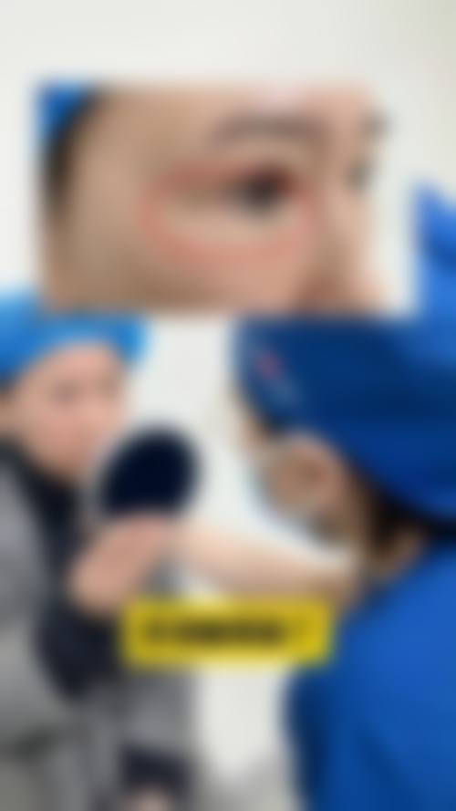 五、随州语卿整形医院实例