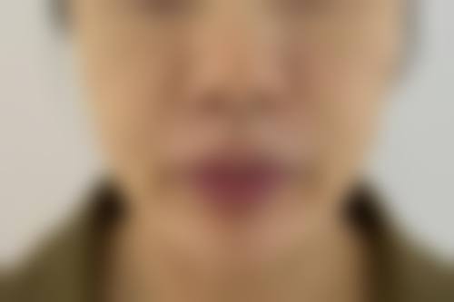 六、西安康美整形美容医院价格表：（仅供参考）