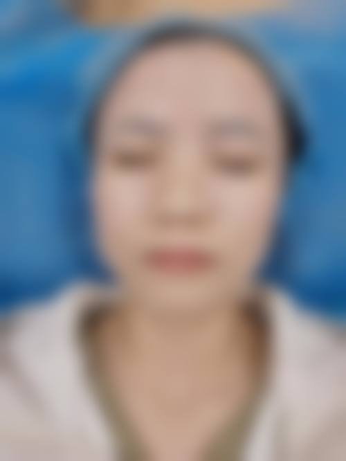 尹晓晴医生在哪家医院