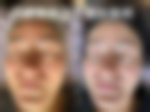 四、西安康美整形美容医院实例