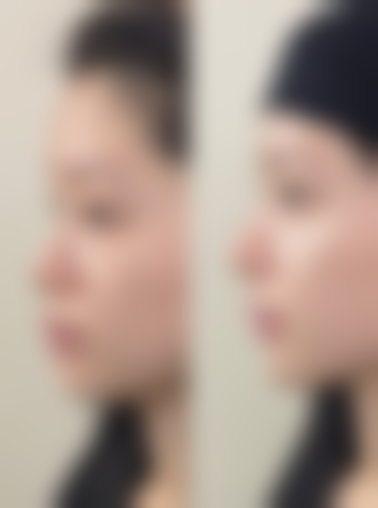 五、海南医学校第二附属医院整形美容科实例