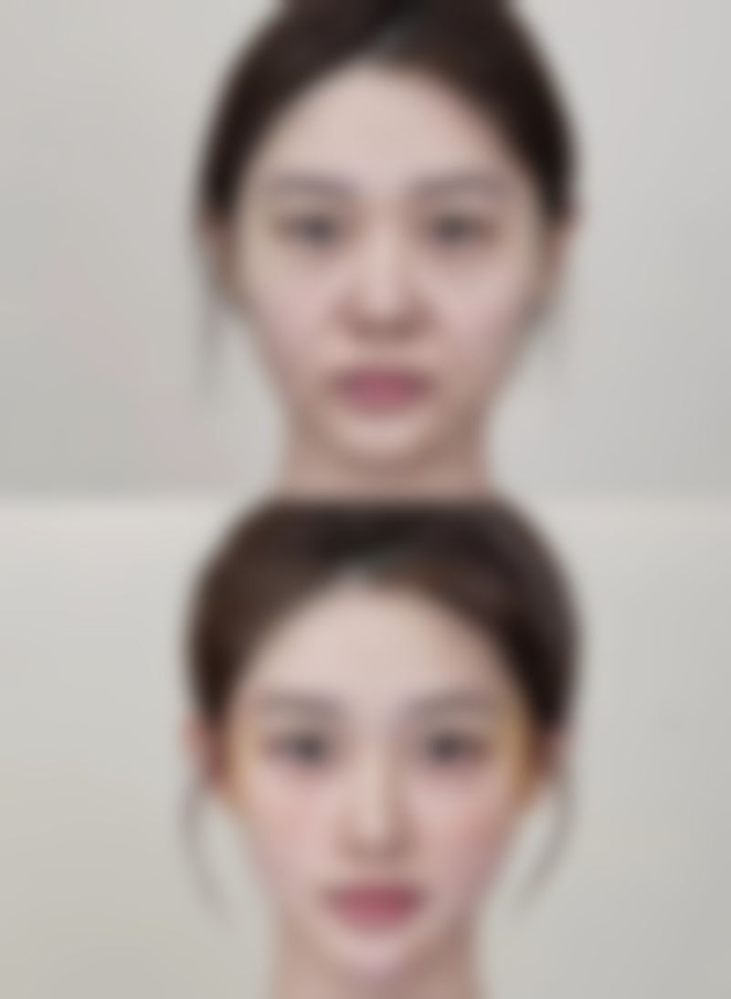 七、韩国延世真整形外科医院价格表：（仅供参考）