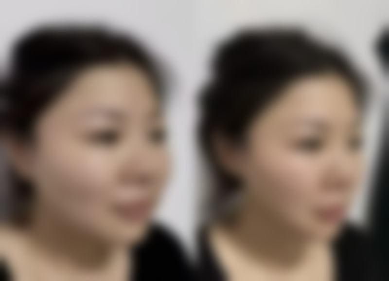 五、韩国延世真整形外科医院实例