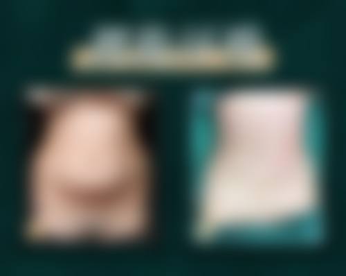 方锦平医生怎么预约？