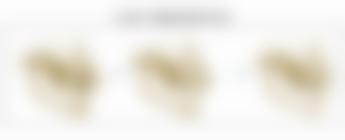 祛眼袋成效大解析：安心长效，持久美丽不是梦