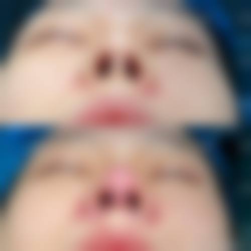 陈(璐)平医生口碑和评价