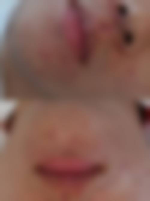 六、熊本Eminal Clinic价格表：（仅供参考）