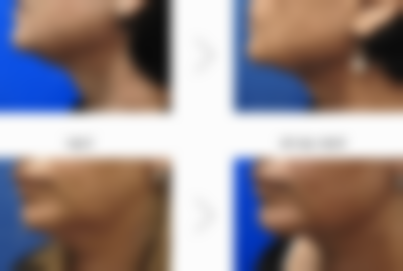 黄在英医生口碑和评价