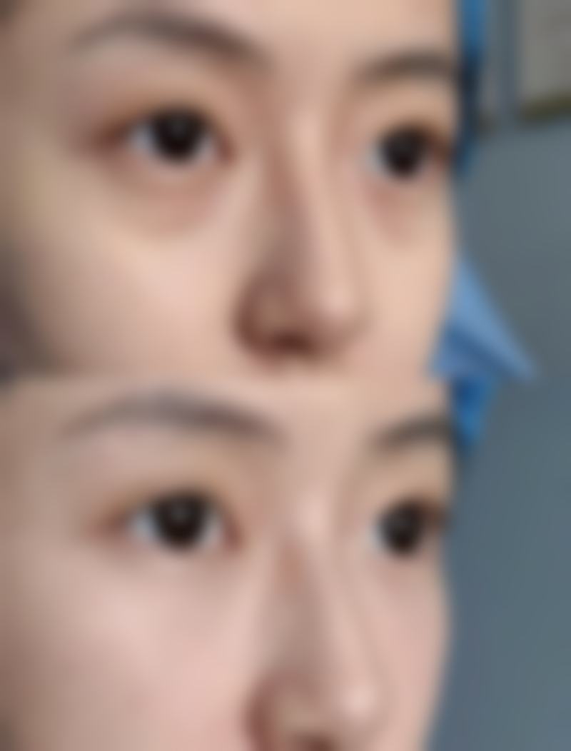 田莉医生项目价格表参考