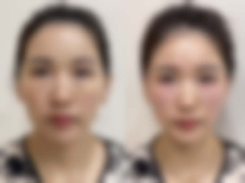 五、南宁美丽之星整形美容机构实例