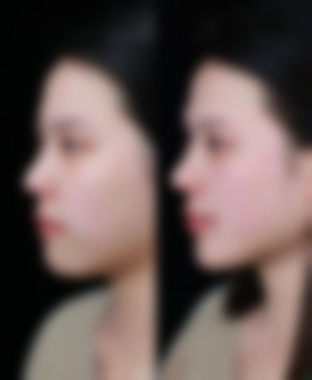 六、南宁美丽之星整形美容机构怎么预约：