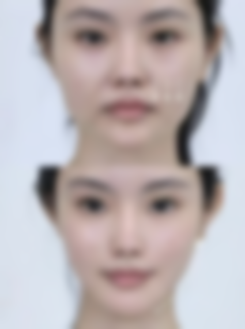 想知道青岛瑧妍美医疗美容医院田莉联系电话？后续服务保护