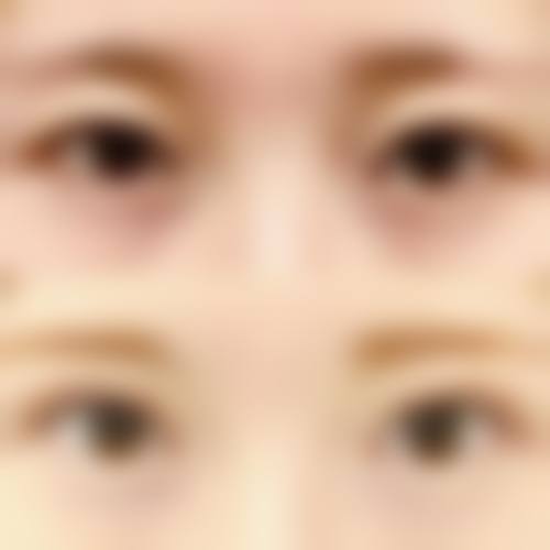 六、江西赣州亚韩医疗美容门诊怎么预约：