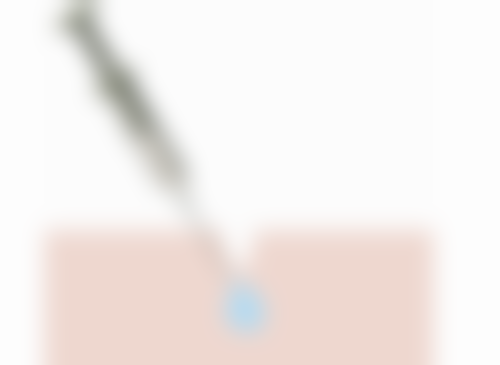 突然双眼皮肿了？深度剖析致病原因，揭秘实用缓解与处理措施 