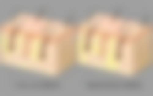 不推荐的手术方案及原因分析