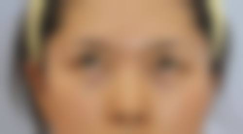 五、浙江省台州医院（整形美容科）实例