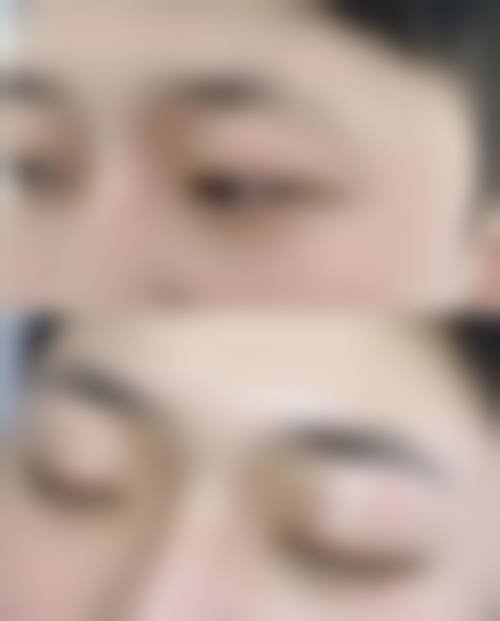 五、鹿儿岛中央美容外科实例