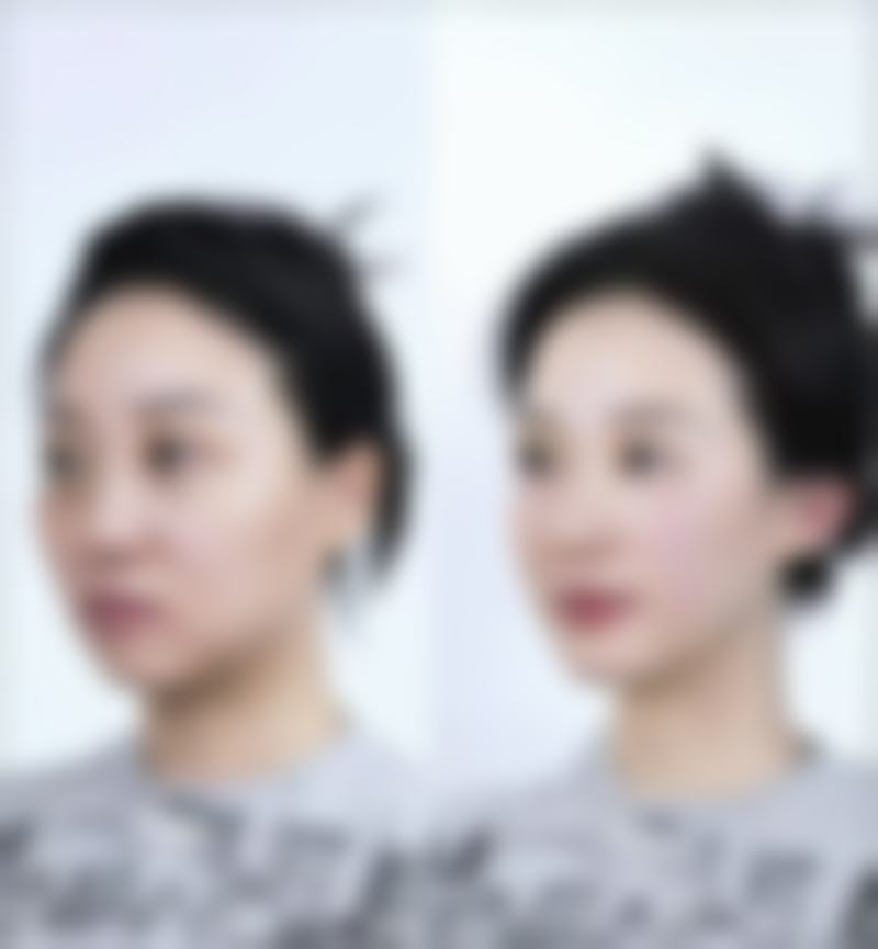 尚绍辉医生项目价格表参考